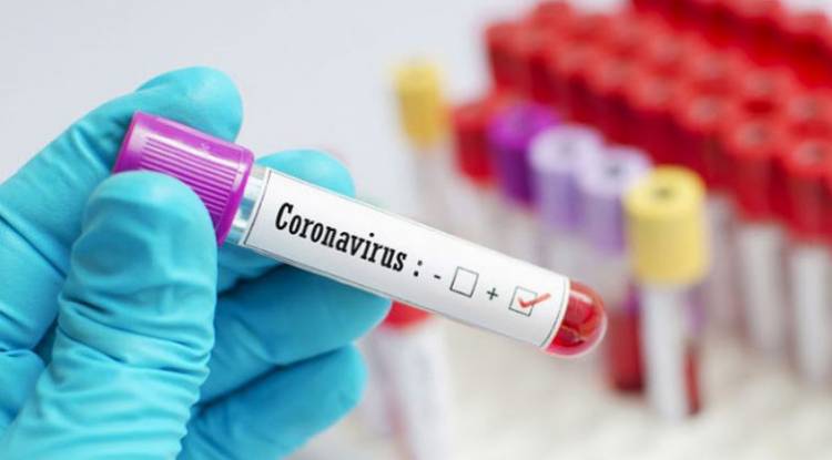 प्युठानमा कोरोना संक्रमितको संख्या सय पुग्यो