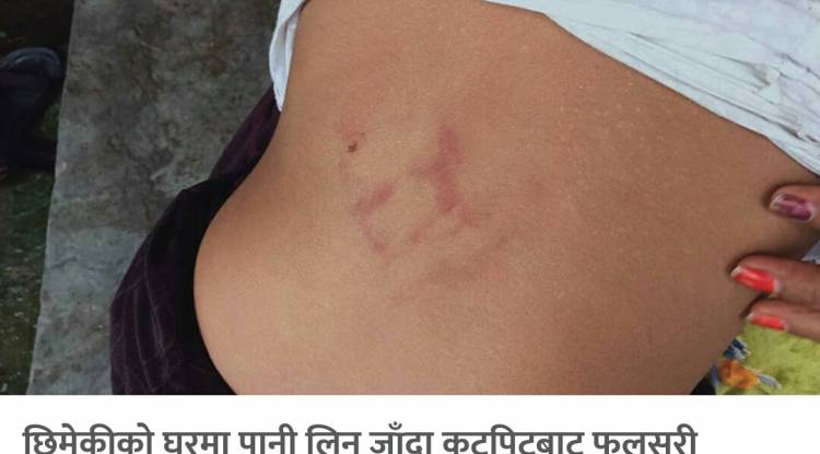 पानी लिन घरभित्र पसेको भन्दै दलित बालिकालाई निर्घात कुटपिट