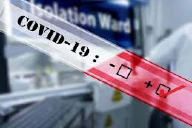 गलकोटमा आज देखि पिसिआर परिक्षण गरिदै