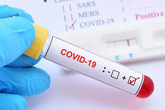 राज्यमन्त्रीका स्वकीय सचिव र चालकमा कोरोना संक्रमण