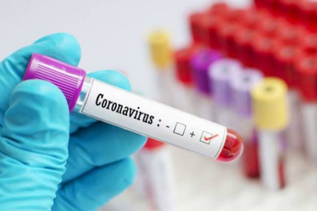 गुल्मिमा थप १४ जनामा कोरोना संक्रमण पुष्टि 