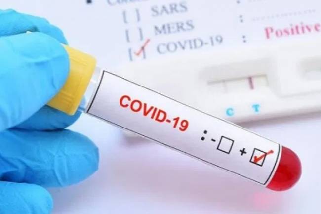 प्युठानमा थप २९ जनामा कोरोना पुष्टि,संक्रमित २९५ पुगे