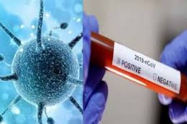 कोरोना अप्डेट : आज कुन जिल्लामा कति भेटिए संक्रमित ?